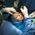 The Most Common Surgeries Among Women